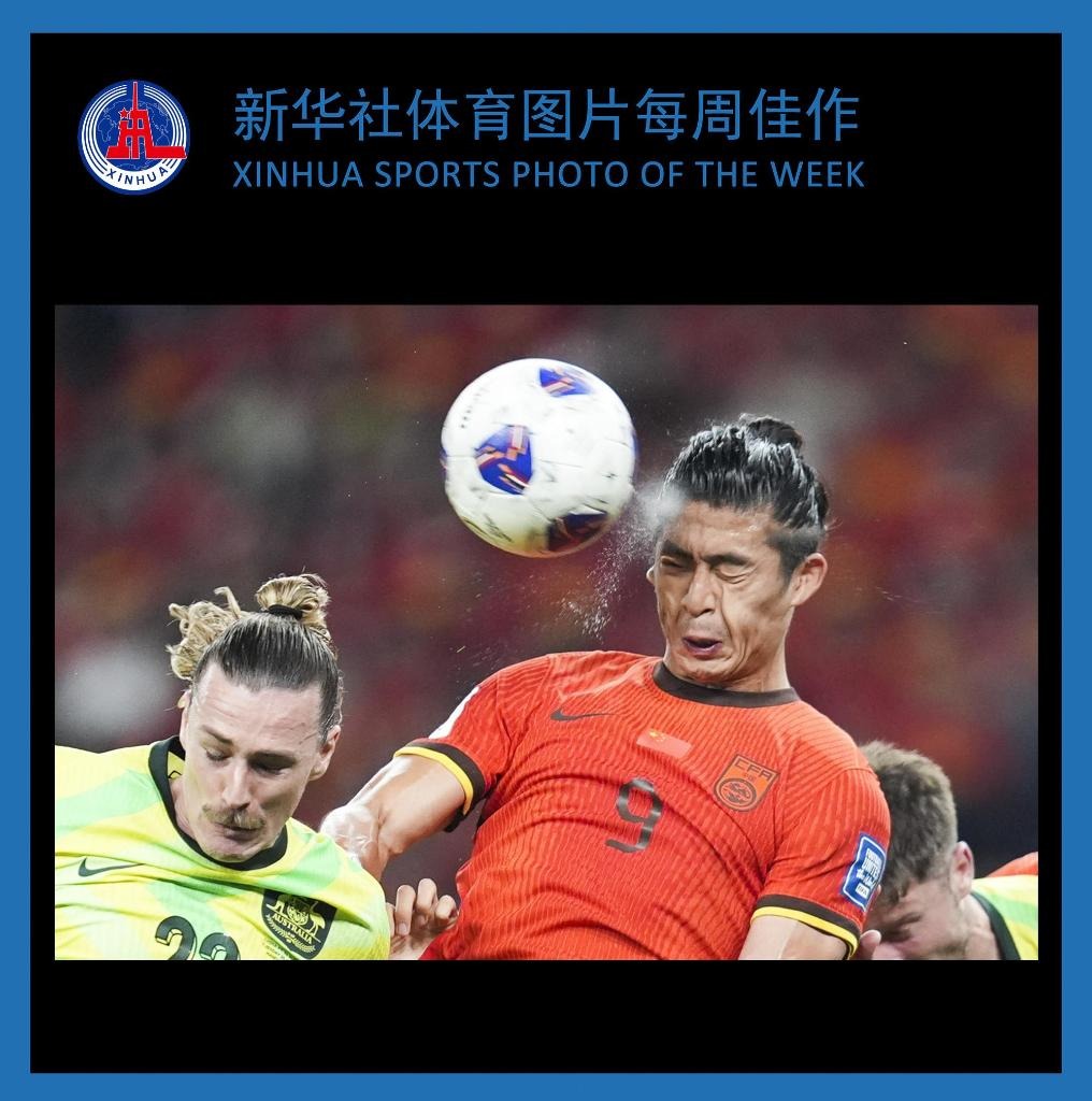 阿尔特塔：赖斯生病了病的很重；球队伤病多并非因为训练过度